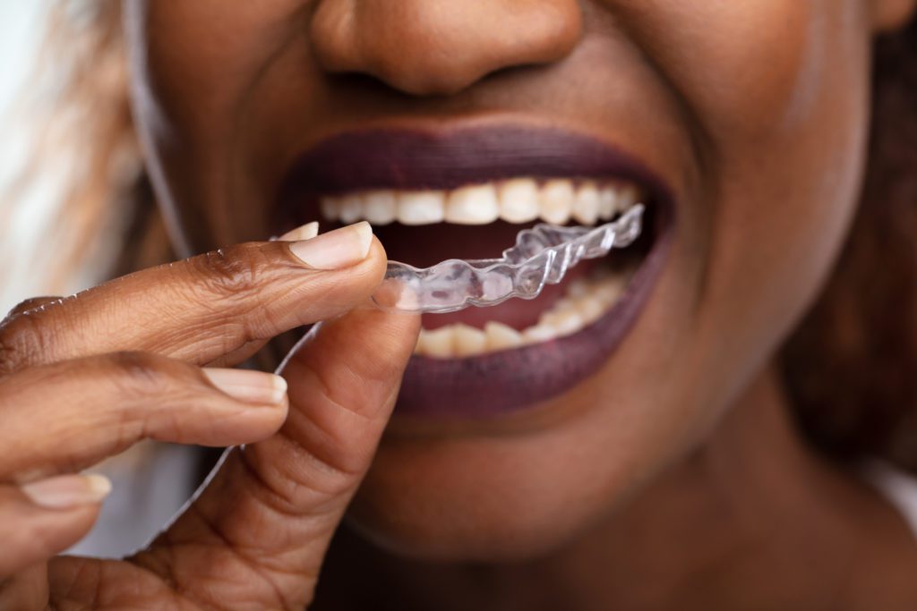 Invisalign in Broomall, Pennsylvania