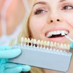 porcelain veneers cosmetic dental benefits