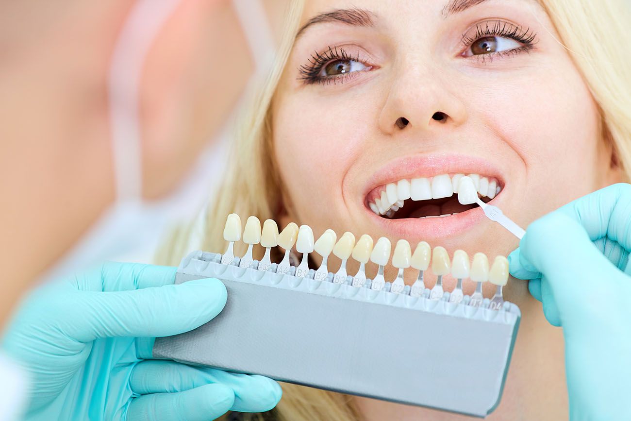 porcelain veneers cosmetic dental benefits