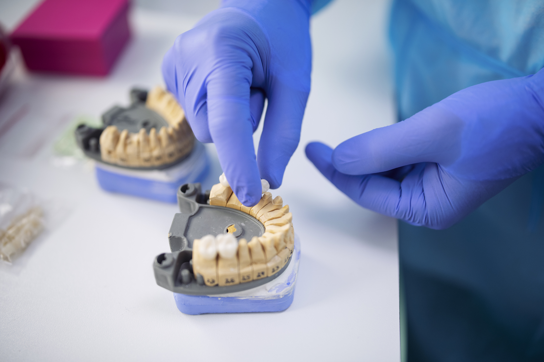 dental crowns in Broomall, PA
