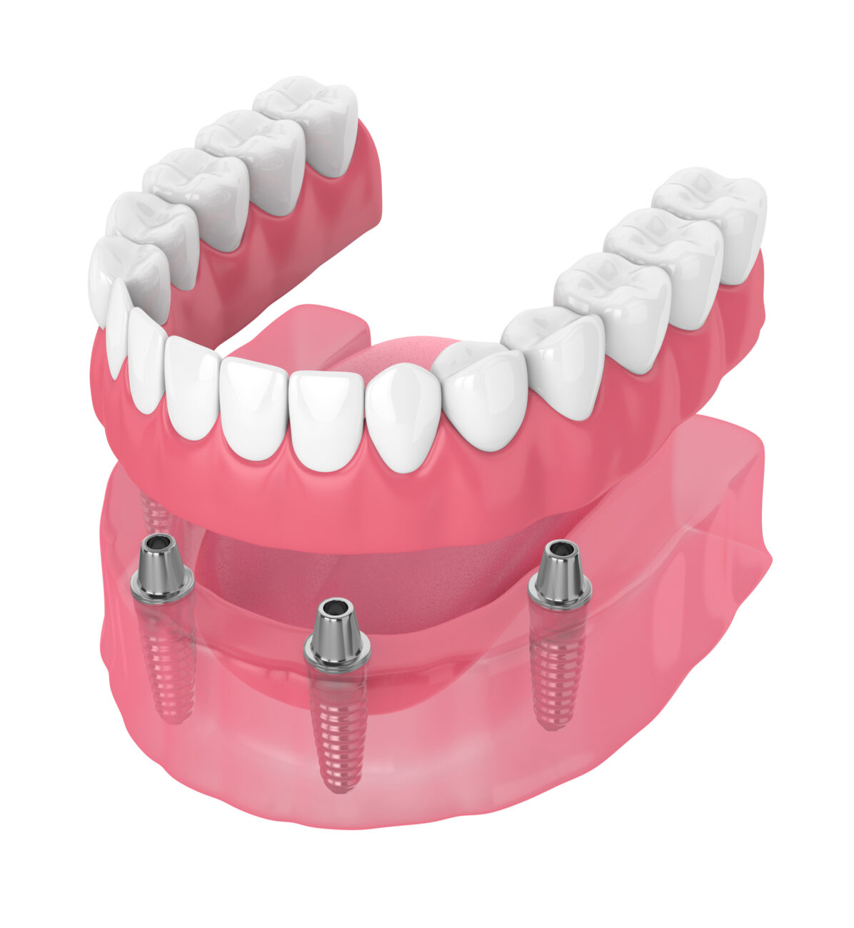 A Denture in Broomall PA may be able to restore your bite after tooth loss