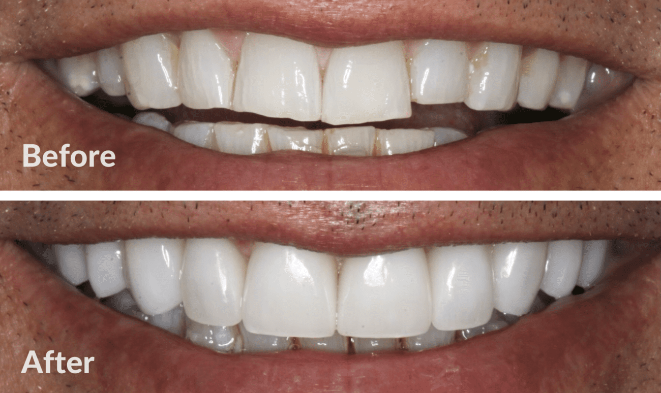 Trial Smile Williamsburg Dental, P.C.